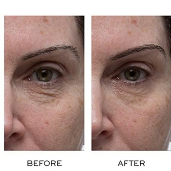 Elemis Peptide 4 Eye Recovery Cream - Picture 4 of 8